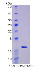 Figure 1. SDS-PAGE
