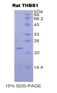 Figure 1. SDS-PAGE