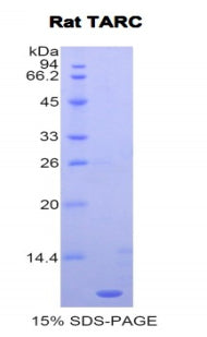 Figure 1. SDS-PAGE