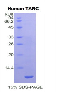 Figure 1. SDS-PAGE