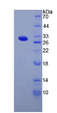 Figure 2. SDS-PAGE