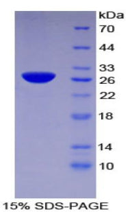 Figure 1. SDS-PAGE