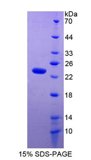 Figure 1. SDS-PAGE