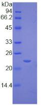 Figure 2. SDS-PAGE