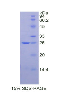 Figure 1. SDS-PAGE