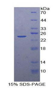Figure 1. SDS-PAGE