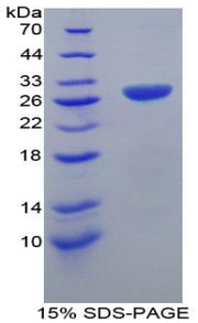 Figure 1. SDS-PAGE