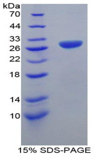 Figure 1. SDS-PAGE
