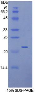 Figure 1. SDS-PAGE