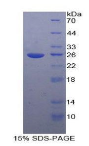 Figure 1. SDS-PAGE