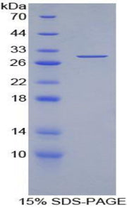 Figure 1. SDS-PAGE