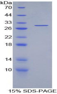 Figure 1. SDS-PAGE