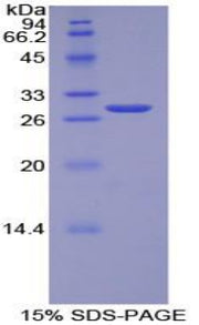 Figure 1. SDS-PAGE