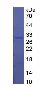 Figure 1. SDS-PAGE