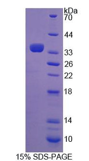 Figure 1. SDS-PAGE