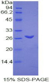 Figure 1. SDS-PAGE