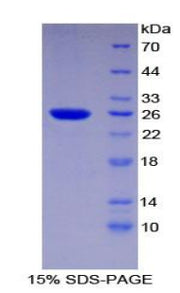 Figure 1. SDS-PAGE