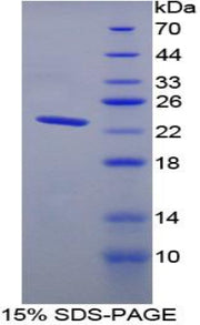 Figure 1. SDS-PAGE