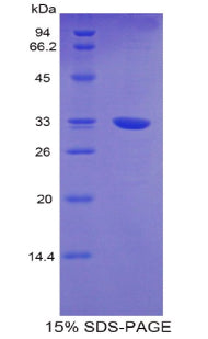 Figure 1. SDS-PAGE