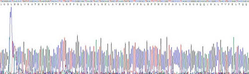 Recombinant Human Tubulin Beta 3 (TUBb3)