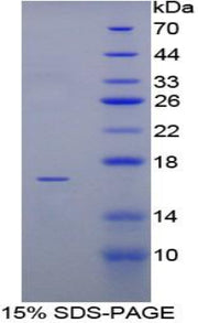 Figure 1. SDS-PAGE