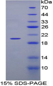Figure 1. SDS-PAGE