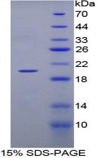 Figure 1. SDS-PAGE