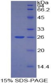 Figure 1. SDS-PAGE