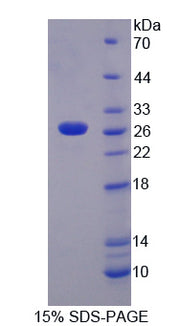 Figure 1. SDS-PAGE