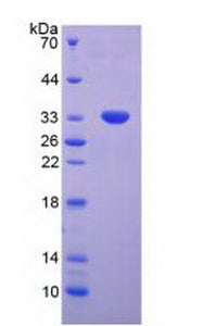 Figure 2. SDS-PAGE