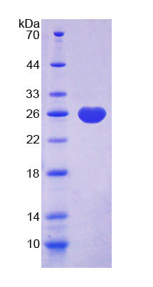 Figure 1. SDS-PAGE