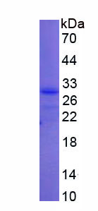 Figure 1. SDS-PAGE