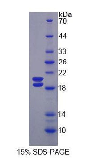 Figure 1. SDS-PAGE
