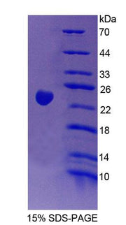 Figure 1. SDS-PAGE