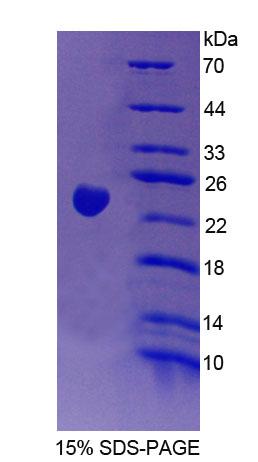 Figure 1. SDS-PAGE