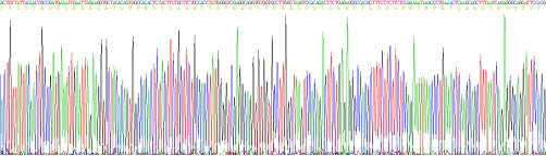 Recombinant Human Versican (VCAN)