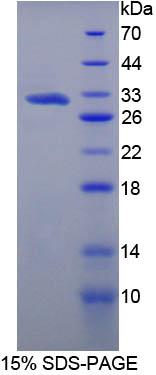 Figure 1. SDS-PAGE