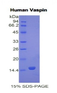 Figure 1. SDS-PAGE