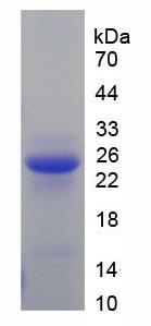 Figure 2. SDS-PAGE