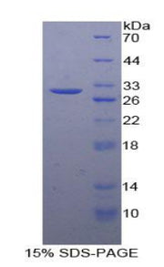 Figure 1. SDS-PAGE