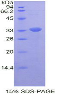 Figure 1. SDS-PAGE