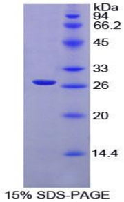 Figure 1. SDS-PAGE