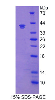 Figure 1. SDS-PAGE