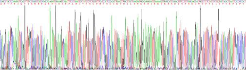 Recombinant Human Beta-2-Microglobulin (b2M)