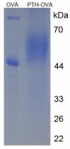 OVA Conjugated Rat Parathyroid Hormone (PTH)