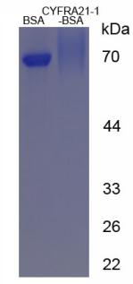 BSA Conjugated Human Cytokeratin Fragment Antigen 21-1 (CYFRA21-1)