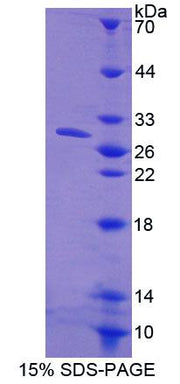 Figure 1. SDS-PAGE