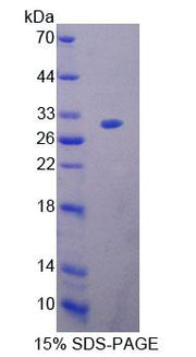 Figure 1. SDS-PAGE