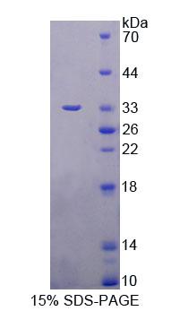 Figure 1. SDS-PAGE