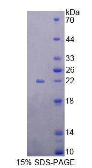 Figure 1. SDS-PAGE